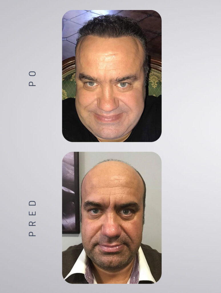 predpo4